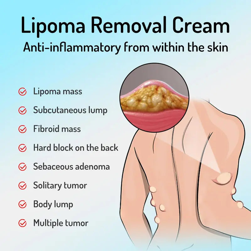 (LAST DAY SALE - 80% OFF🔥)Relieve subcutaneous lumps caused by lipoma-fat cream