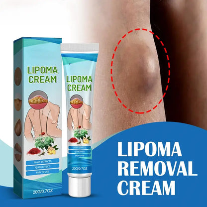 (LAST DAY SALE - 80% OFF🔥)Relieve subcutaneous lumps caused by lipoma-fat cream
